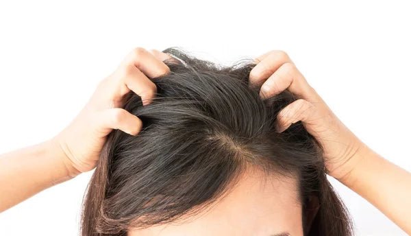 Caspa: O Que é. Causas, e Sintomas - Glow Headspa