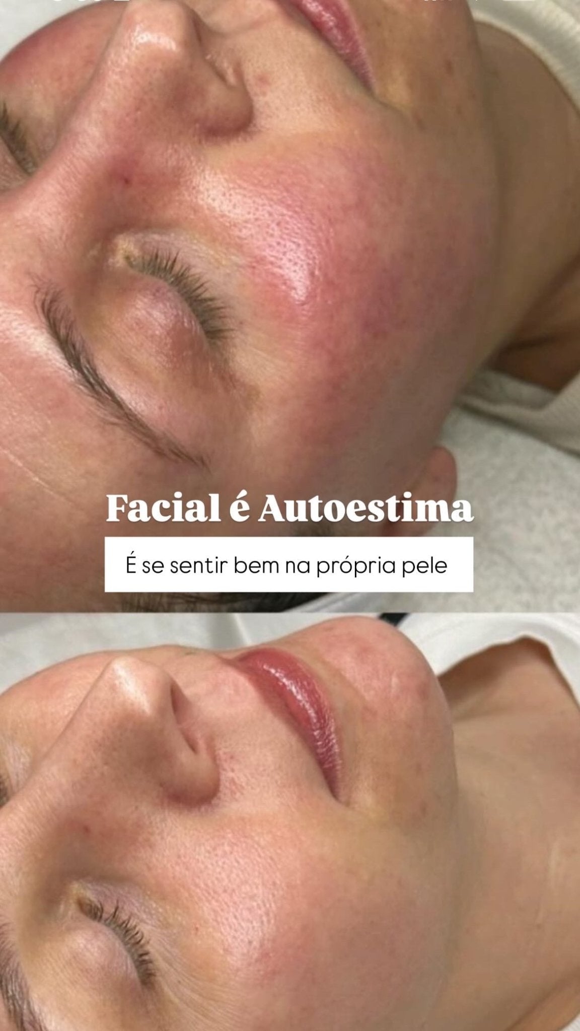 headspa headsapcoreano spacoreano tratamentocoreano headspasaopaulo