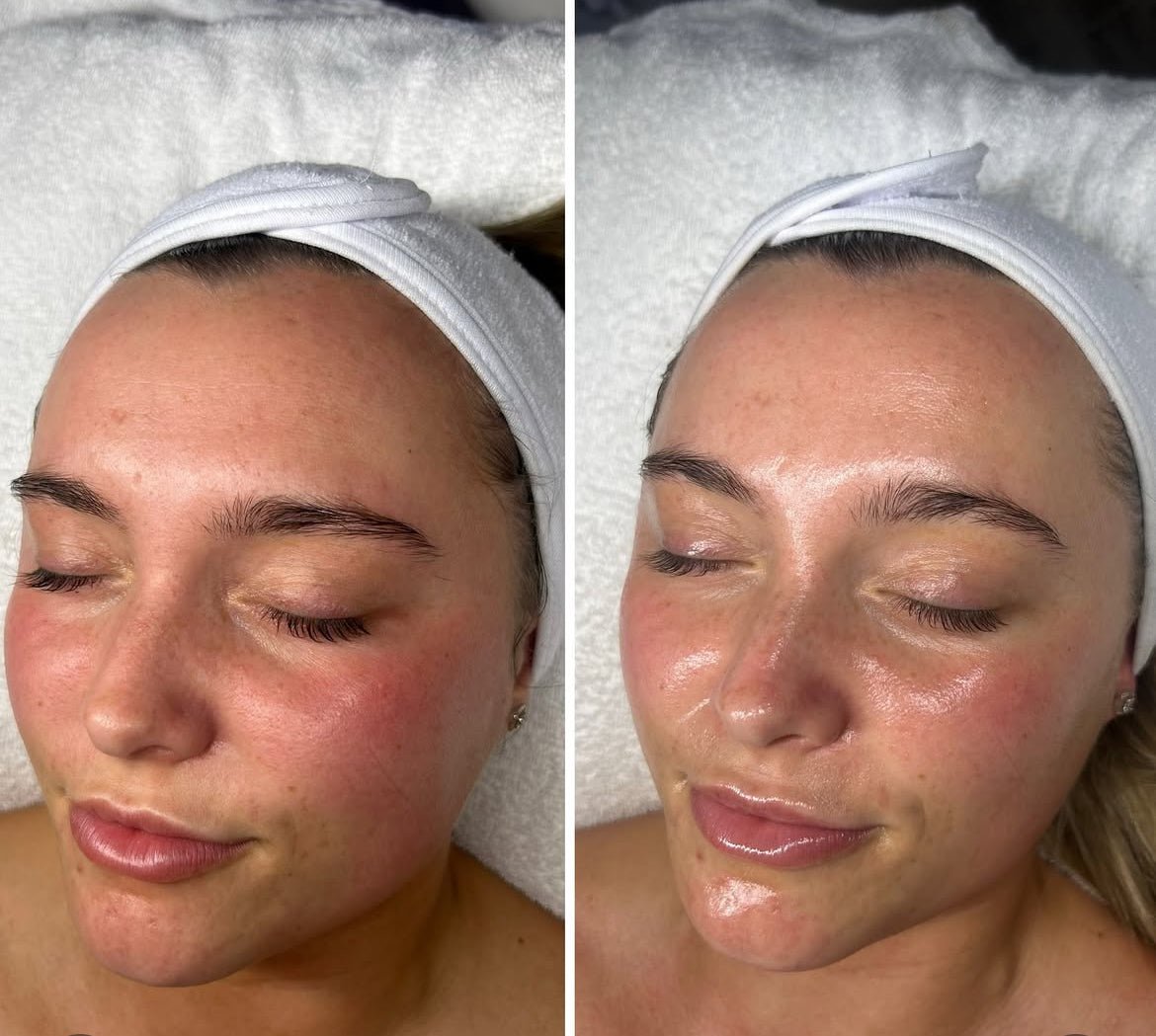 headspa headsapcoreano spacoreano tratamentocoreano headspasaopaulo