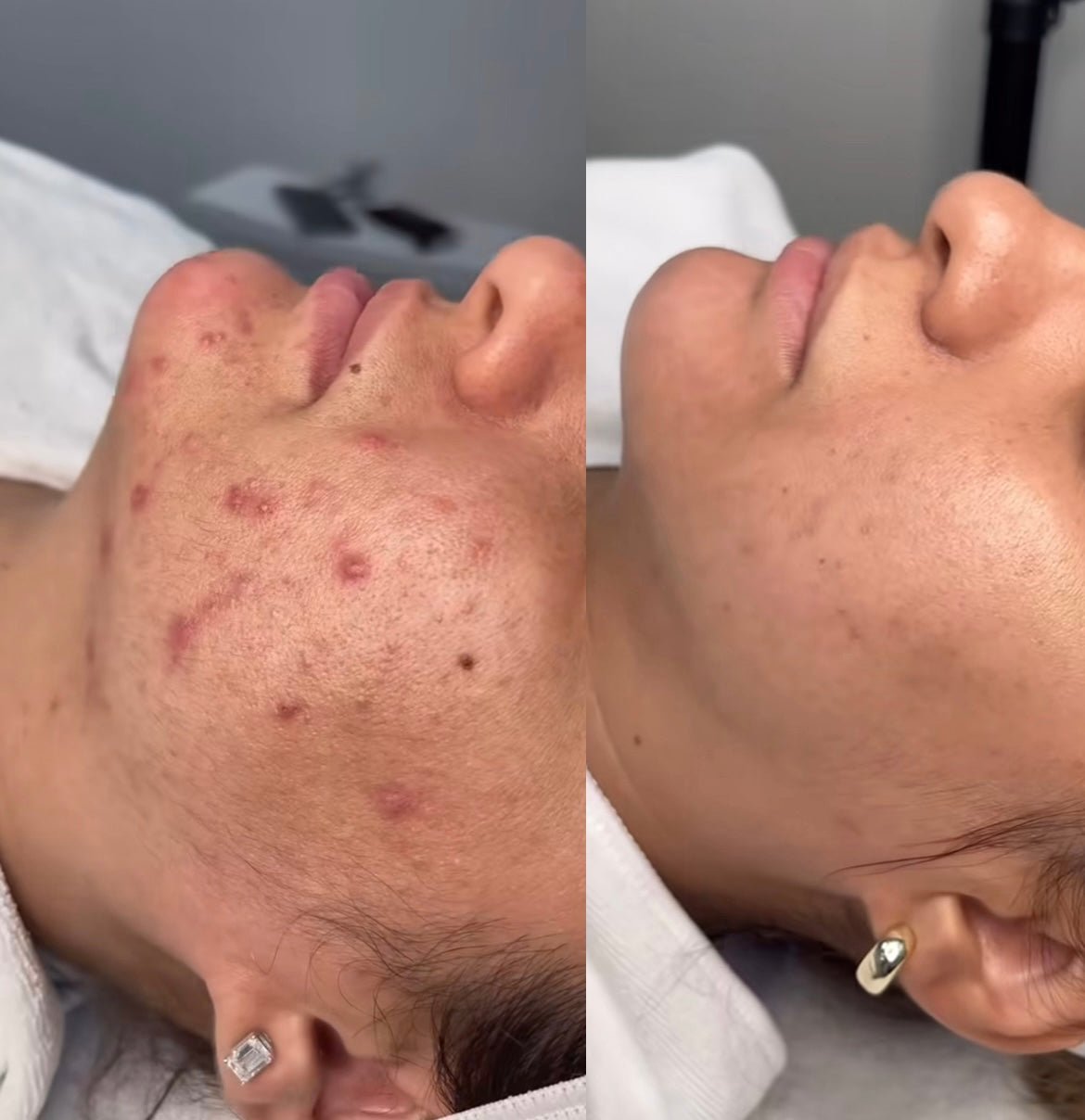 headspa headsapcoreano spacoreano tratamentocoreano headspasaopaulo