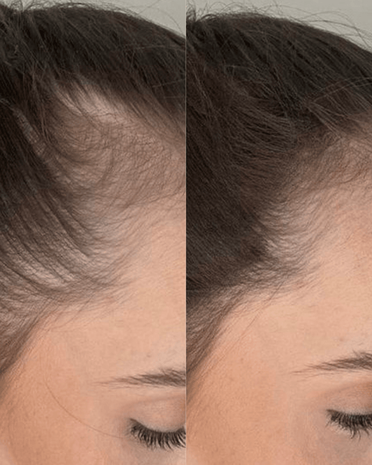 headspa headsapcoreano spacoreano tratamentocoreano headspasaopaulo