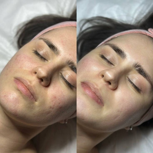 headspa headsapcoreano spacoreano tratamentocoreano headspasaopaulo