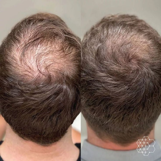 headspa headsapcoreano spacoreano tratamentocoreano headspasaopaulo