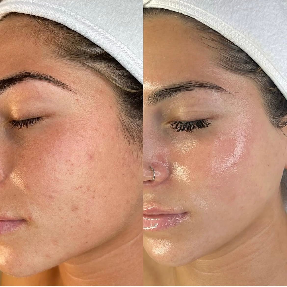 headspa headsapcoreano spacoreano tratamentocoreano headspasaopaulo