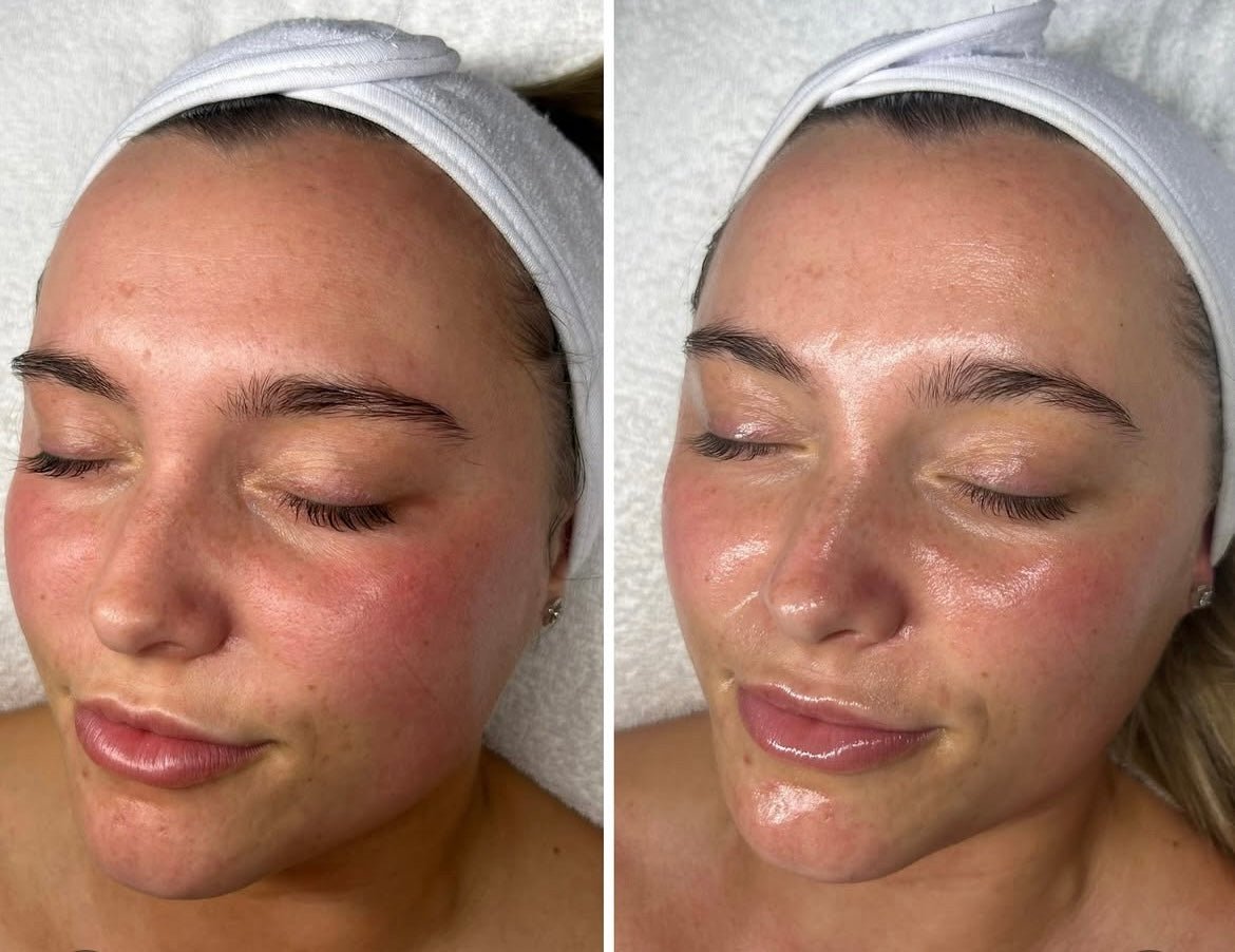 headspa headsapcoreano spacoreano tratamentocoreano headspasaopaulo
