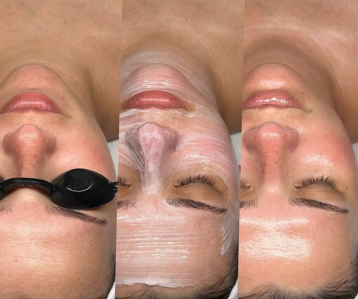 headspa headsapcoreano spacoreano tratamentocoreano headspasaopaulo