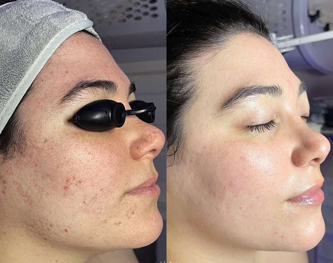 headspa headsapcoreano spacoreano tratamentocoreano headspasaopaulo