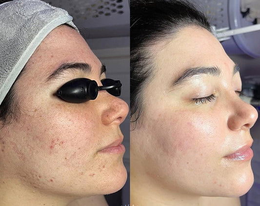 headspa headsapcoreano spacoreano tratamentocoreano headspasaopaulo