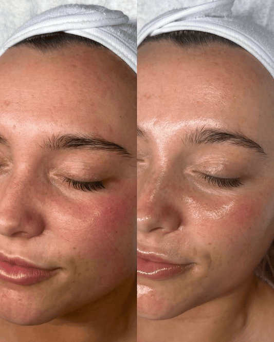 headspa headsapcoreano spacoreano tratamentocoreano headspasaopaulo